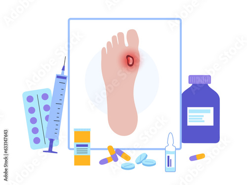 Diabetic Foot Ulcers