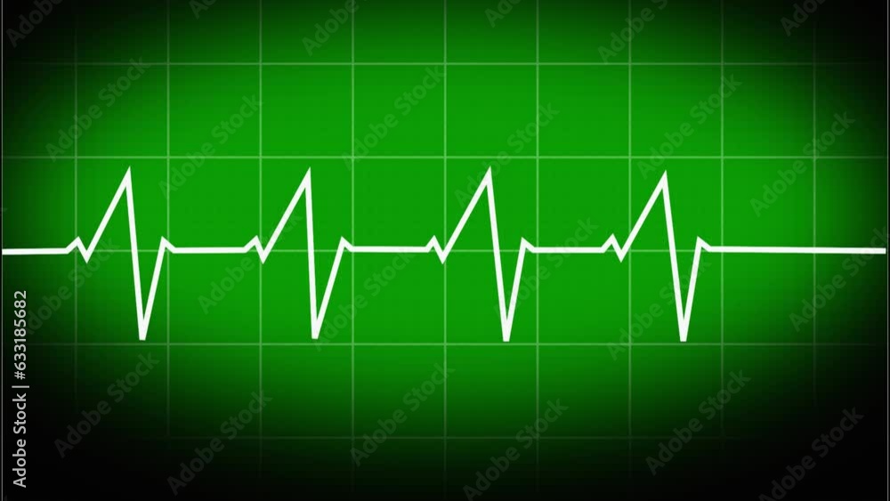 A vector-based image Heartbeat ECG display. The heartbeat. Electrocardiogram. a single pulse line. Cardiogram, or heart pulse line wave, or ECG. history of electrocardiogram in medicine. A vector-based image Heartbeat ECG display. The heartbeat. Electrocardiogram. a single pulse line. Cardiogram, or heart pulse line wave, or ECG. history of electrocardiogram in medicine.