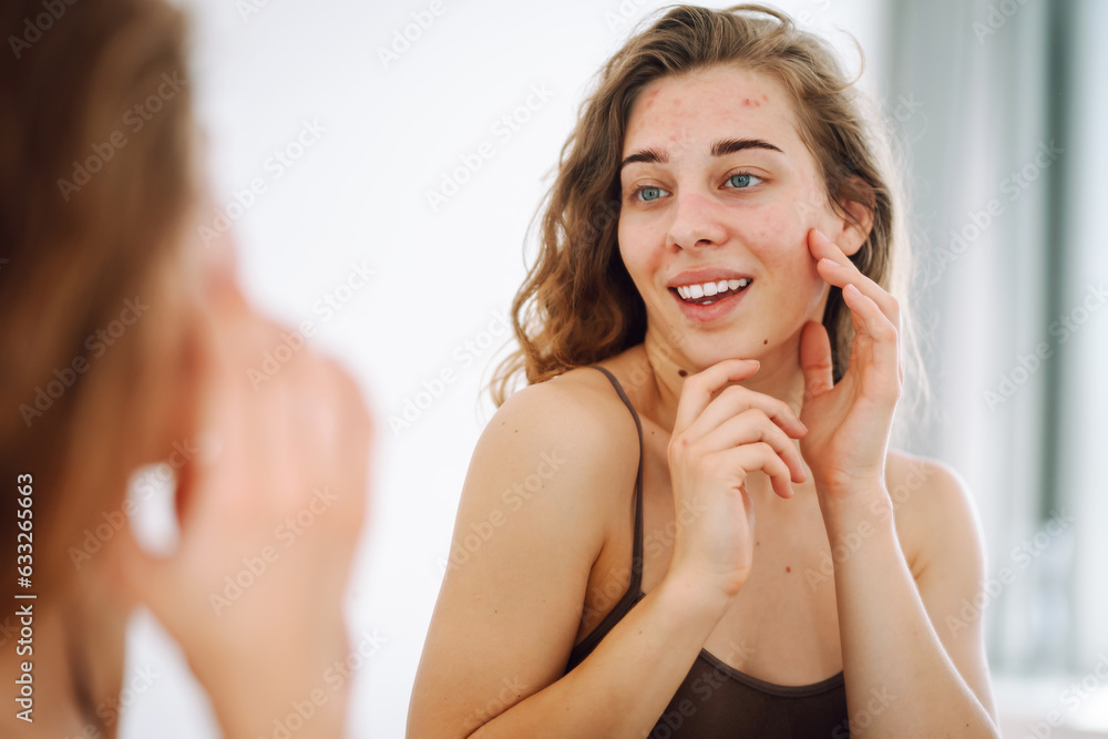 Close-up of a young woman looking at pimples in the mirror. Beautiful woman with acne problem skin checks dry face skin. Red spots, rash, acne. Skin treatment. Close-up of a young woman looking at pimples in the mirror. Beautiful woman with acne problem skin checks dry face skin. Red spots, rash, acne. Skin treatment.