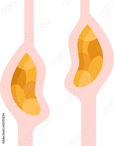 esophageal  icon