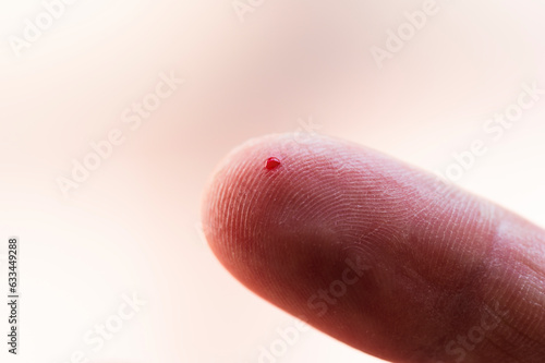 Small wound on the tip of the index finger from which blood is oozing. Method to check blood sugar for diabetes.