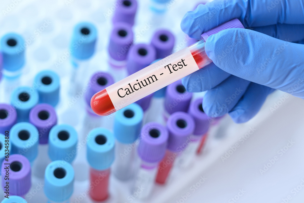 Obraz premium Doctor holding a test blood sample tube with calcium test on the background of medical test tubes with analyzes
