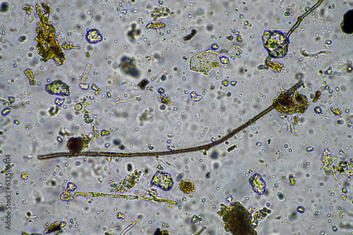 fungal hyphae and soil fungi in a soil sample, showing the living soil photo