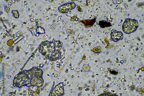Canvastavla fungal hyphae and soil fungi in a soil sample, showing the living soil