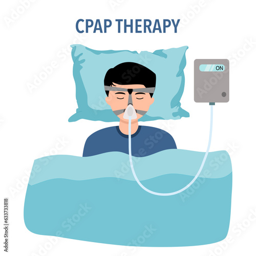 CPAP therapy is a treatment for obstructive sleep apnea. A CPAP machine uses a hose connected to a mask or nosepiece to deliver constant and steady air pressure to help you breathe while you sleep.