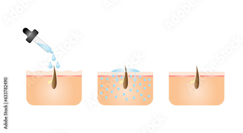 Hyaluronic acid. Difference between Low molecular and High molecular hyaluronic acid. anti-aging therapy, skincare products. Vector illustration.