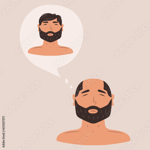 

Flat vector illustration with memories of a man before baldness, hair loss, alopecia at a young age, hair problems, baldness.
