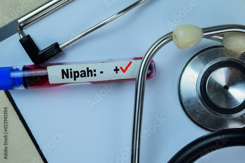 Nipah - Test with blood sample. Top view isolated on office desk. Healthcare or Medical concept photo
