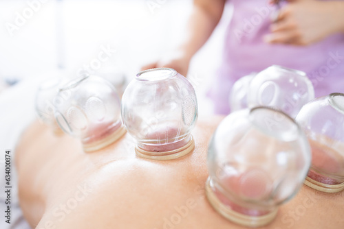 Hijama medical treatment for body relaxation and pain relief. Close up view of suction cups.