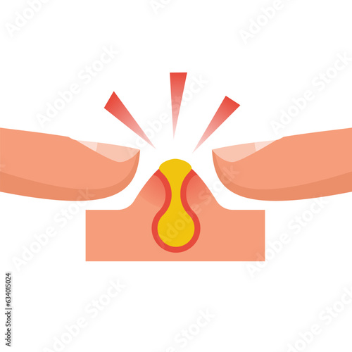 Two fingers squeeze a pimple. Acne icon. Pimple on the skin. Diseases on the skin. Vector illustration flat design. Isolated on white background.