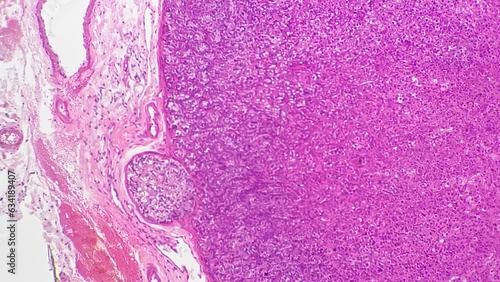 Section of human adrenal gland filmed under microscope with 200 times magnification on white background. Macro view of man organ showing different layers of cells. Producing steroid hormones theme photo