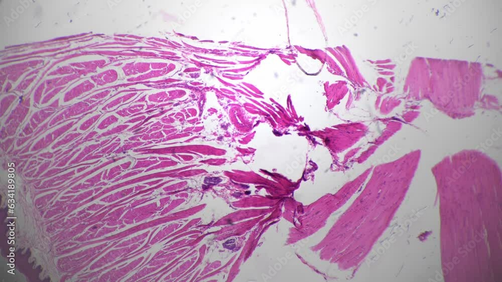 Human tongue in longitudinal section showing filiform papillae under