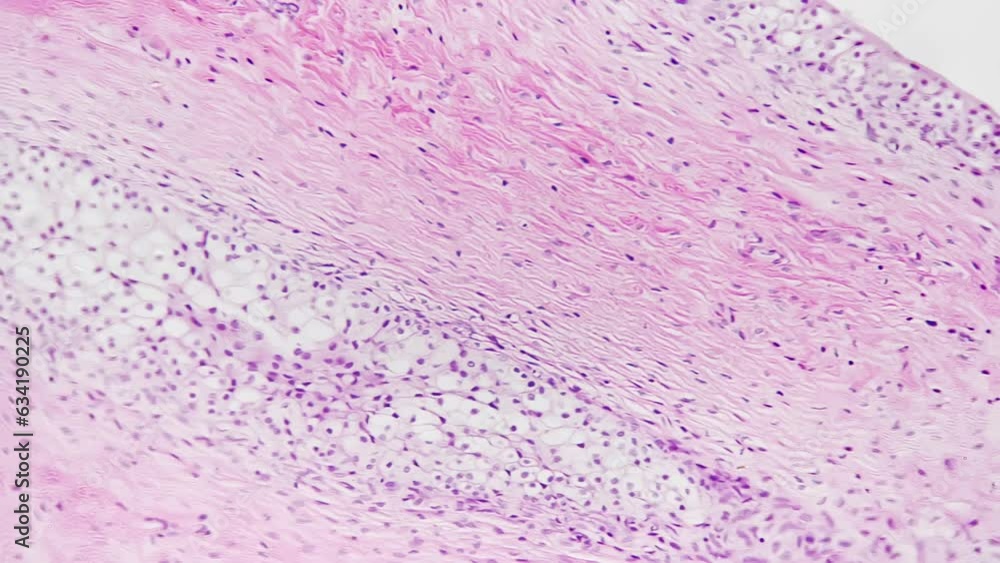 Section of man transitional epithelium filmed under microscope 200x on ...