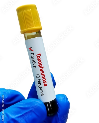 Blood sample for Toxoplasma test photo