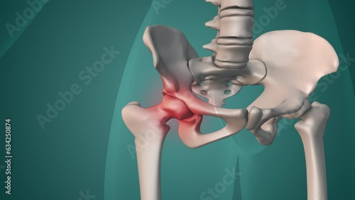 Human painful hip medical concept photo