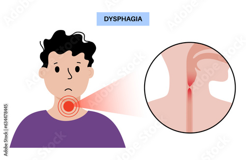 Dysphagia medical poster