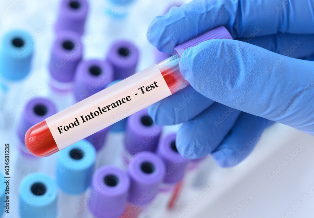 Doctor holding a test blood sample tube with food intolerance test on the background of medical test tubes with analyzes.Copy space for text Doctor holding a test blood sample tube with food intolerance test on the background of medical test tubes with analyzes.Copy space for text