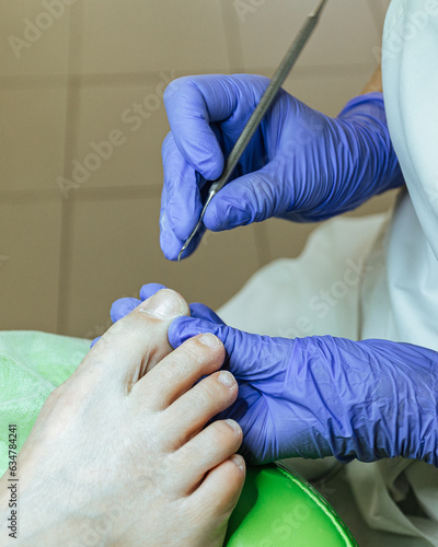 A close-up of the process of making a pedicure by a master. Foot care in medical centers. Professional medical pedicure procedure while doctor using nail instrument. Treatment of the skin of the foot 