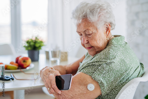 Diabetic senior patient checking blood glucose level at home using continuous glucose monitor.