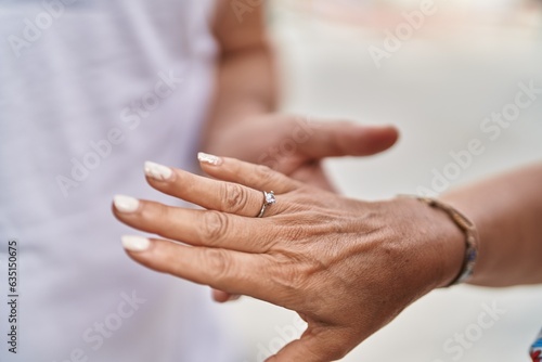 Man and woman couple putting engagement ring at street