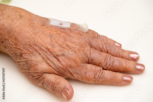 Close up old woman hand, upper limb or arm to the wounded waiting for nurse treatment on wound dressing a bloody and brine of patient on white background.