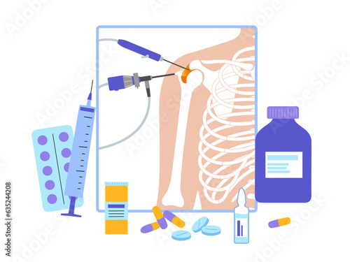 Shoulder arthroscopy poster