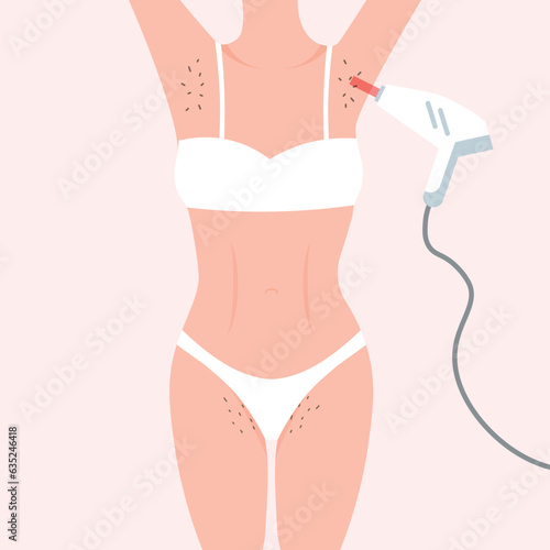 Laser hair removal. Woman hairy armpits and bikini area. Female beauty salon poster. Vector illustration in a trendy flat style isolated.