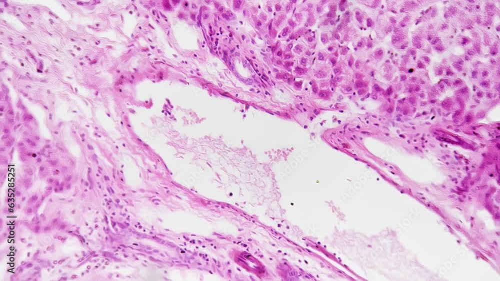 Closeup view of the liver vessel injection in microscope section at 200x magnification set against a bright field. Isolated section of the organ playing a crucial role in detoxification and metabolism Closeup view of the liver vessel injection in microscope section at 200x magnification set against a bright field. Isolated section of the organ playing a crucial role in detoxification and metabolism