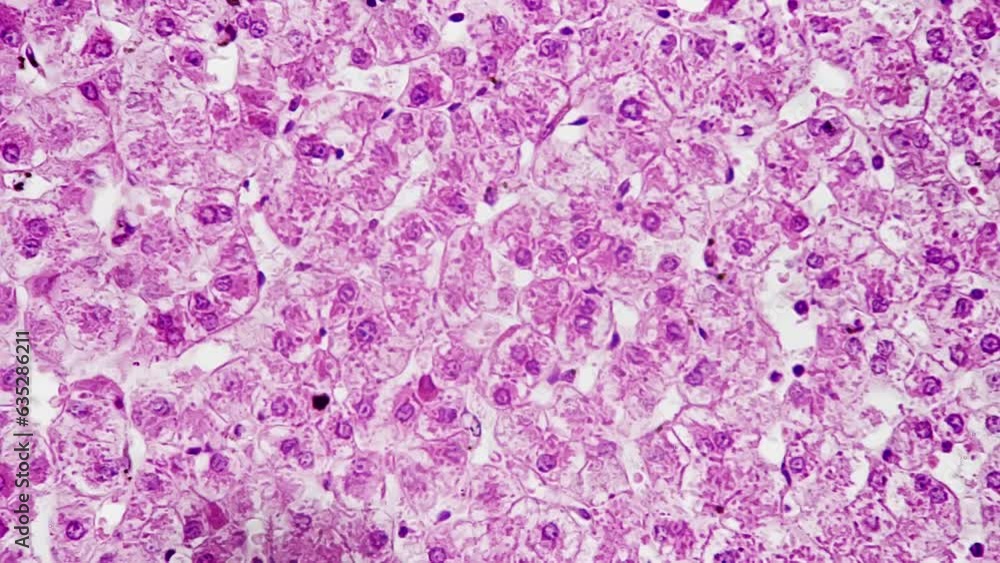 Closeup view of the liver vessel injection in microscope section at 400x magnification set against a bright field. Isolated section of the organ playing a crucial role in detoxification and metabolism Closeup view of the liver vessel injection in microscope section at 400x magnification set against a bright field. Isolated section of the organ playing a crucial role in detoxification and metabolism
