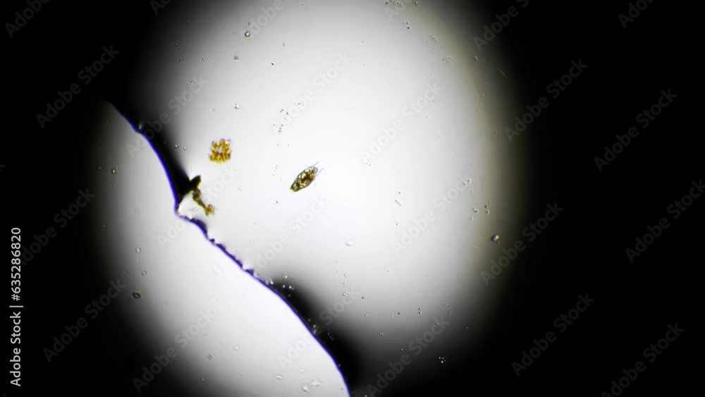 Vidéo Stock Microscopic footage of rotifer moving in fresh water sample ...