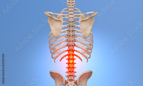 Lower spine with red indicating pain