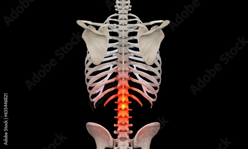 Lower spine on black with pain highlights photo