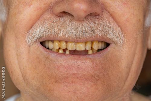 Fotografie, Obraz Close-up macro shot of toothless male smile mouth of senior elderly man
