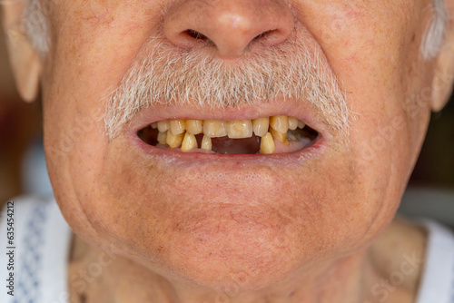 Bild auf Leinwand Close-up macro shot of toothless male smile mouth of senior mature man