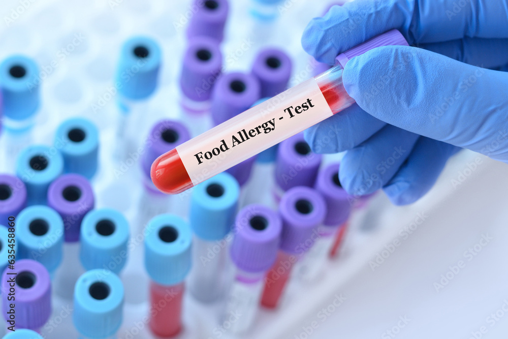 Obraz premium Doctor holding a test blood sample tube with food allergy test on the background of medical test tubes with analyzes
