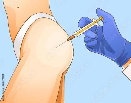 Beauty injections. Non-surgical correction. Injection for bigger buttocks. Healthcare illustration. Beauty illustration. Vector illustration. 