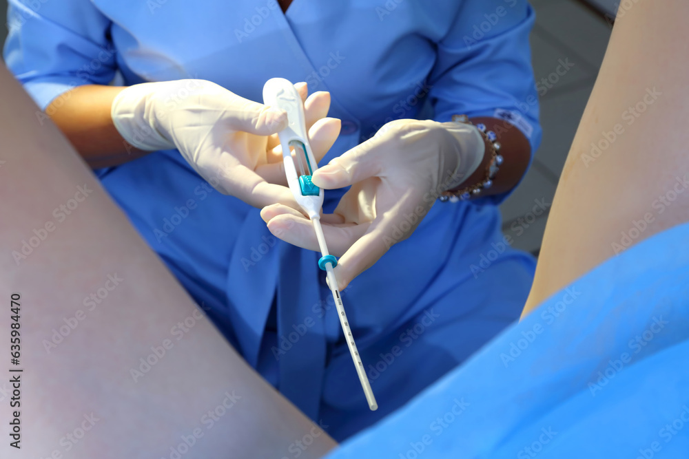 Contraceptive IUD. Installation of a birth control system. The
