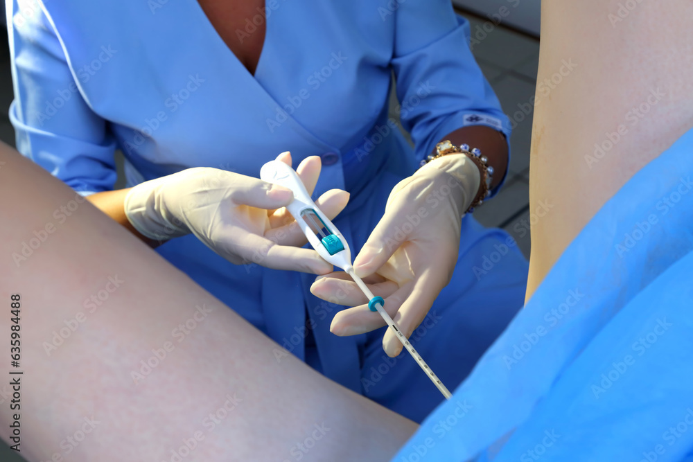 Foto de Contraceptive IUD. Installation of a birth control system. The ...