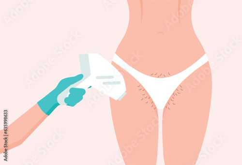 Laser hair removal. Doctor hand in gloves holds equipment. Woman hairy bikini area. Female beauty salon poster. Vector illustration in a flat style.