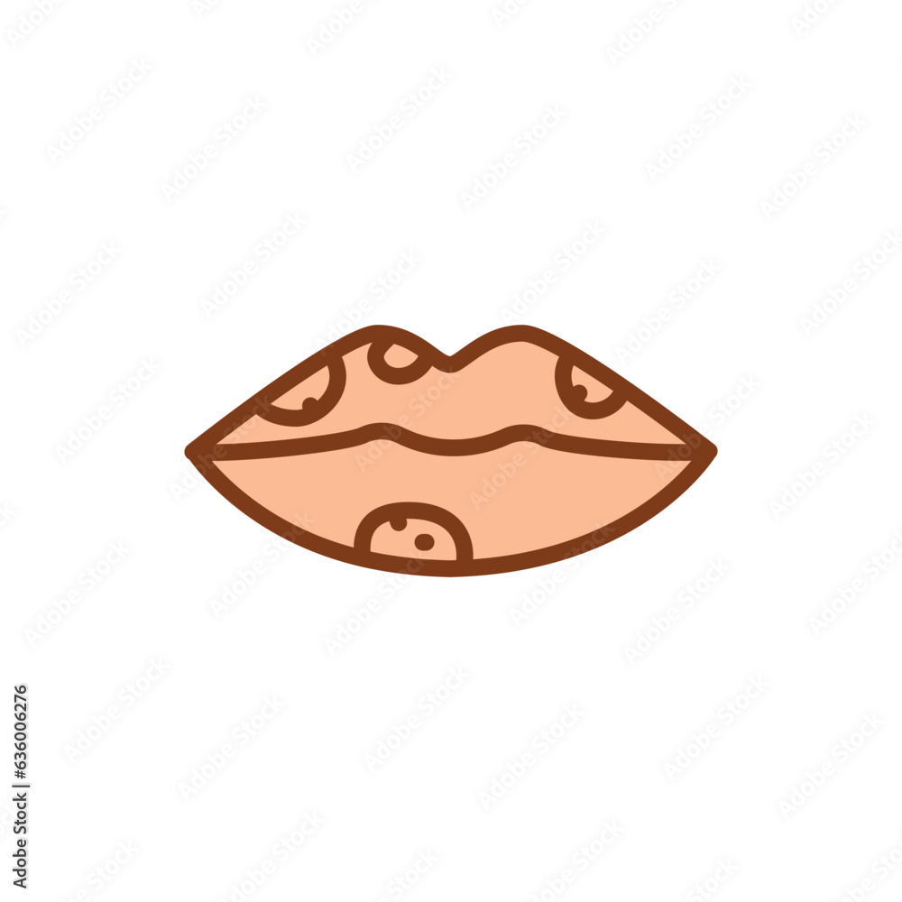 Herpes lips black line icon. Dermatology disease. Herpes lips black line icon. Dermatology disease.