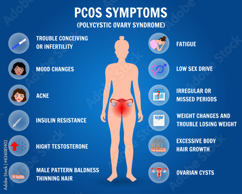 Polycystic ovary syndrome gynecology information in vector, pcos symptoms 