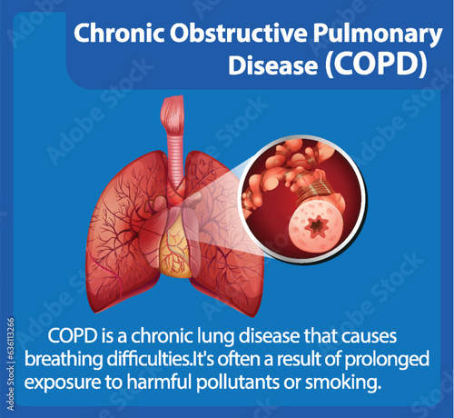 Science Education of Human Anatomy: COPD Infographic