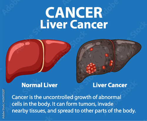 Comparing Healthy and Cancerous Liver Cell Growth