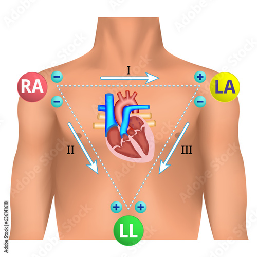 Standard Limb Leads ECG - Einthoven Triangle - Electrocardiogram Lead Position - Medical Vector Illustration