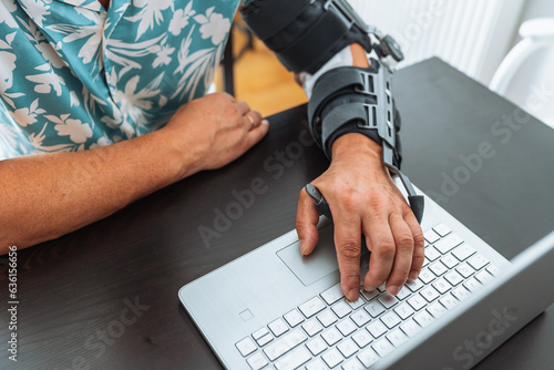 Obraz na płótnie Man with adjustable articulated elbow orthosis typing on laptop keyboard