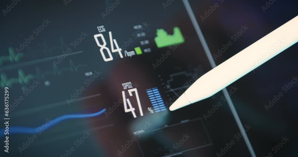 Doctor shows vital signs ECG measurement, medical data of patient with