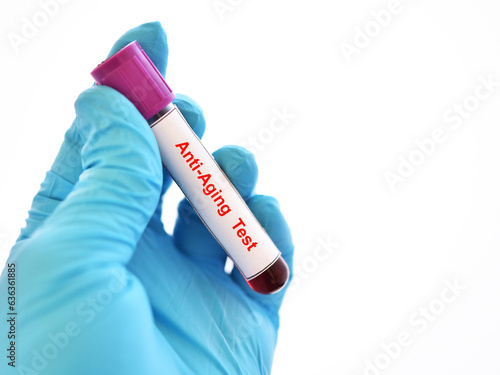 Test tube with blood sample for anti-aging test  photo