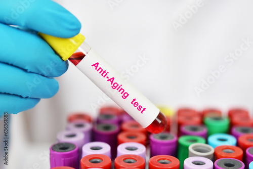 Test tube with blood sample for anti-aging test  photo