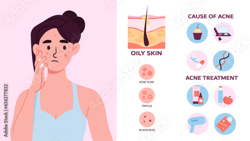Woman with problem with skin concept. Skincare and fight against acne. Beauty treatments and cosmetic products. Oily skin with papule and blackhead. Cartoon flat vector illustration