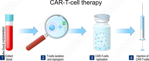 CAR T-cell therapy.  medical procedure